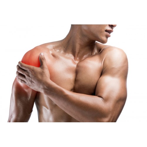 Impingement Syndrome