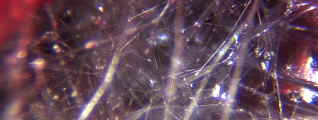 THINGS TO KNOW ABOUT FASCIA THINGS TO KNOW ABOUT FASCIA