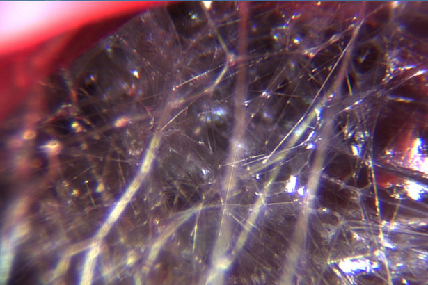 THINGS TO KNOW ABOUT FASCIA
